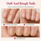 Close-up examples of natural nail texture and surface ridges